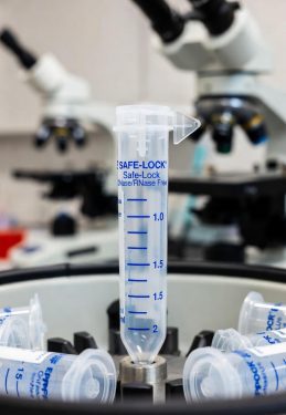 خرید اینترنتی میکروتیوب استریل و مقاوم | ویژه آزمایشگاه‌ها