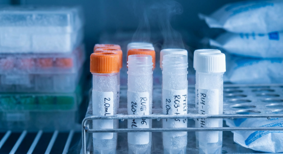 میکروتیوب با درب محکم و مقاوم در سانتریفیوژ 